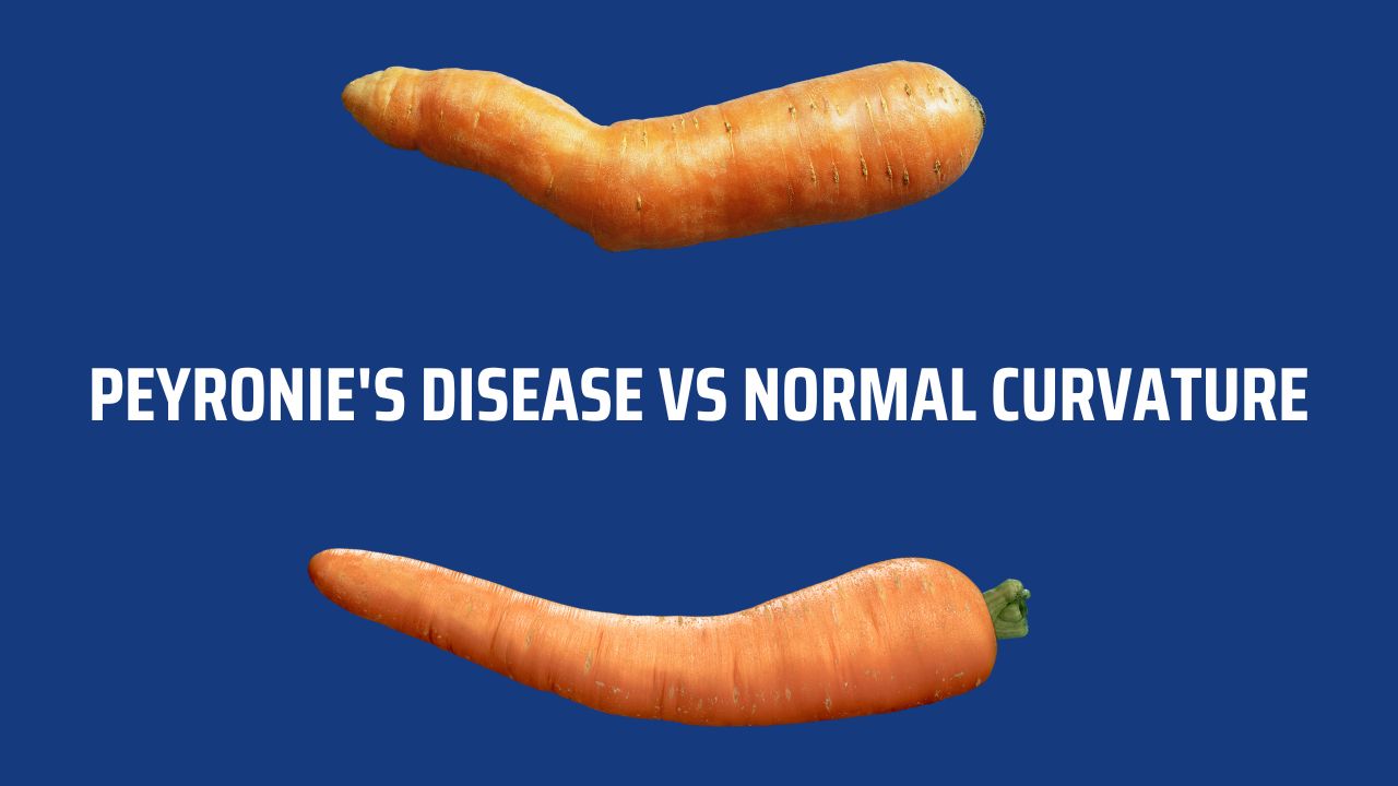 Peyronie S Disease Vs Normal Curvature Here S What You Should Know