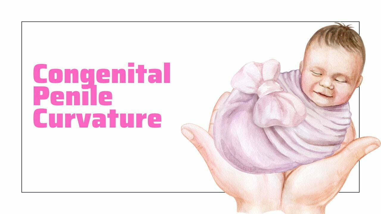 Congenital Penile Curvature Causes Symptoms Treatment